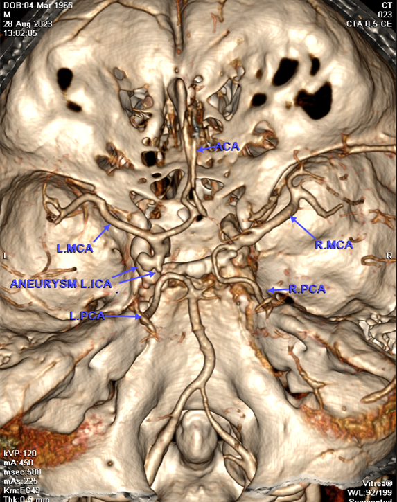 ct-1-1709700012.png