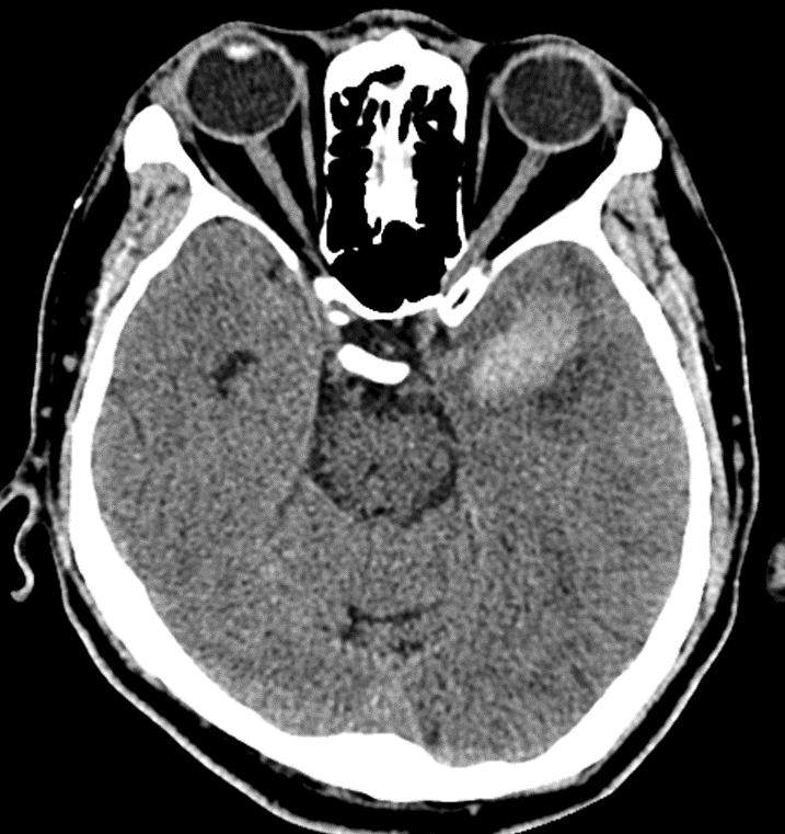 ct-2-1709700026.png