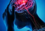 Đột quỵ gia tăng: Nghiên cứu Mỹ hé lộ thủ phạm mới