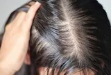 Lời khuyên cho những người hay bị rụng tóc