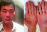 Người đàn ông không bia rượu nhưng ngày nào cũng bị kiểm tra nồng độ cồn, biết sự thật phía sau ai cũng xót xa