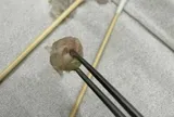 Bé gái 6 tuổi nhập viện khẩn cấp, bố mẹ "sốc" khi bác sĩ lấy ra thứ "đáng sợ" từ mũi con