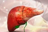 1 thói quen "phá" gan nhanh hơn rượu bia: Gặp ở rất nhiều người Việt