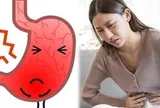 Cảnh báo: Không phải đồ ăn cay, đây mới là 4 "thủ phạm" gây ung thư dạ dày phổ biến nhất