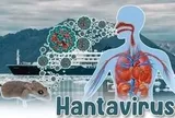 Bộ Y tế lên tiếng về dịch bệnh do virus Hanta