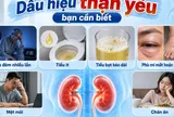 5 cách cải thiện thận yếu đơn giản tại nhà