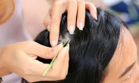 Hóa ra đây là lý do bạn không nên nhổ tóc bạc