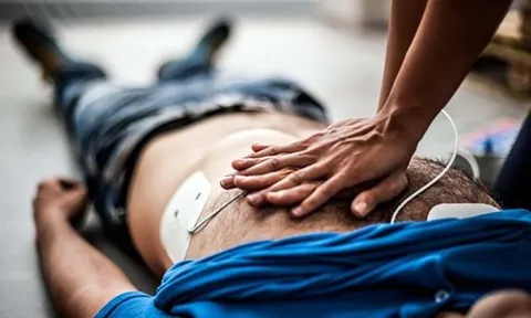 60% người trẻ ĐỘT TỬ không kịp tới bệnh viện: Cơ thể đã “báo động” từ trước, nhưng thường bị bỏ qua