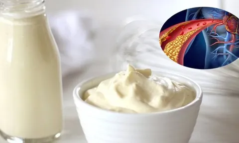 Loại thực phẩm giới trẻ đặc biệt yêu thích nhưng cẩn trọng kẻo gây rối loạn mỡ máu