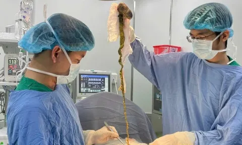 Lấy búi tóc khổng lồ ra khỏi dạ dày bé trai ở Đà Nẵng