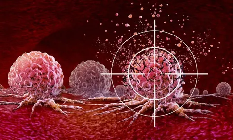 Ung thư rất ‘thích’ 2 loại thực phẩm này, chuyên gia cảnh báo: "Cần hạn chế ăn ngay lập tức"