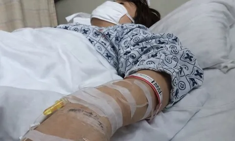 Người phụ nữ 30 tuổi phải chạy thận suốt đời vì uống cà phê giảm cân