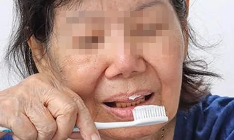 Người phụ nữ 50 tuổi nhất quyết đánh răng bằng nước muối pha loãng, 1 năm sau kết quả gây chấn động