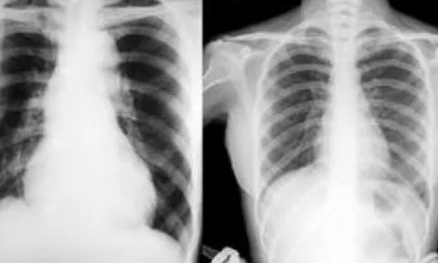 Vướng mắc thanh toán X-quang dưới 6 phút, BHXH Việt Nam lên tiếng