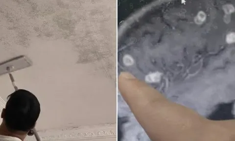 Bé gái 6 tuổi bị "đục" 20 lỗ ở não, suýt thành người thực vật: 5 góc khuất chứa đầy “chất độc vô hình” phải cẩn trọng khi dọn dẹp nhà đón Tết