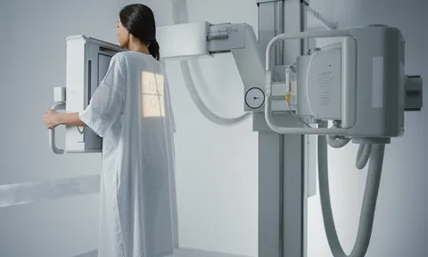 Bộ Y tế: Chụp X-quang đủ 6 phút không phải căn cứ duy nhất để trả bảo hiểm y tế