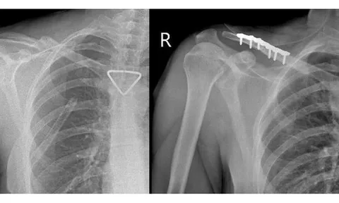 Thêm 1 du khách người Nga được bác sĩ cấp cứu kịp thời