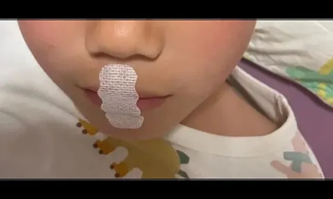 Bé trai 5 tuổi suýt thiếu oxy giữa đêm vì "bảo bối nuôi con" này: Tuyệt đối đừng dùng bừa bãi!