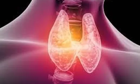 Nhiều người đi siêu âm phát hiện có nang giáp, bác sĩ chỉ ngay 5 dấu hiệu cảnh báo cần đi khám lại ngay lập tức