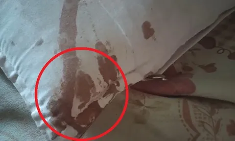 Nửa đêm tỉnh giấc, bé gái lớp 7 kinh hãi phát hiện vết máu loang trên gối: Thủ phạm nằm ngay trong nhà