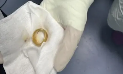 Khám cho cụ ông, bác sĩ phát hiện ra "bí mật" bất ngờ