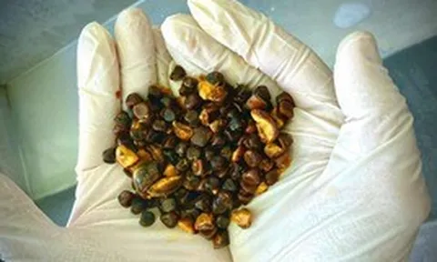 Có thể bạn chưa biết: Loại “đá” kỳ lạ trong bụng bò này hiện đang đắt hơn cả vàng!