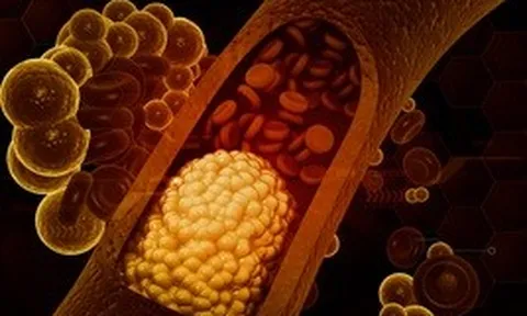 Ăn nhiều rau luộc, ít thịt cả 3 bữa trong ngày nhưng mỡ máu vẫn cao vút: Bất ngờ với "thủ phạm"