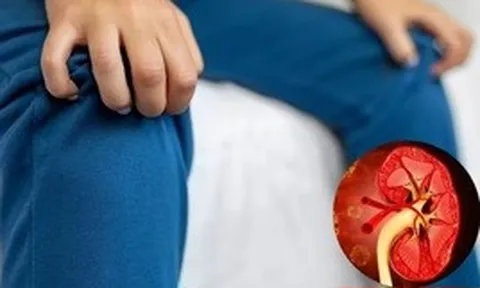 Muốn biết thận khỏe hay yếu, cứ nhìn vào tay và chân sẽ rõ: Có 7 dấu hiệu này thì phải đi khám sớm!