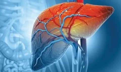 Ung thư gan tại Việt Nam gia tăng báo động: Kiểm soát được 3 thứ này, giảm được 2/3 số ca mắc