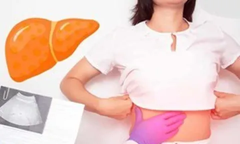 Với gan nhiễm mỡ, ngoài “ngậm miệng và đá chân", còn có 1 việc bắt buộc phải làm mà nhiều người không biết