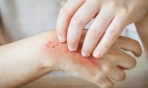 Muốn biết thận khỏe hay không, cứ nhìn vào da sẽ rõ: Đây là 7 dấu hiệu nếu có cần đi khám ngay