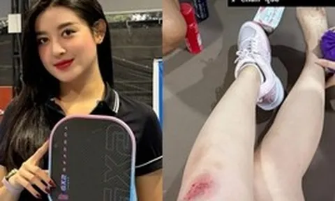 Á hậu Huyền My gặp tai nạn khi chơi pickleball