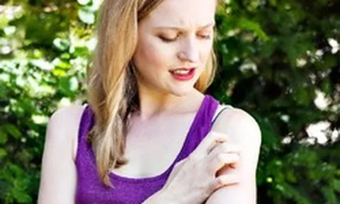 Câu nói 'người xinh đẹp thường thu hút muỗi' có hoàn toàn vô lý?