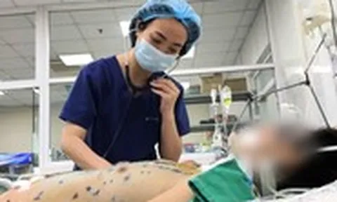 Cẩn trọng thủy đậu gây suy đa tạng, nguy hiểm tính mạng  ở người lớn