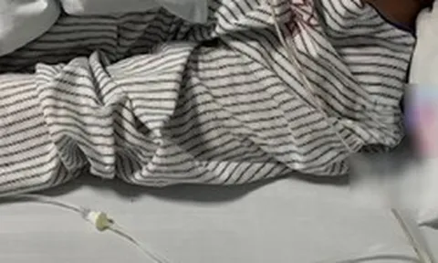 Chàng trai 30 tuổi mắt phải bỗng bị mờ, đi khám bác sĩ kết luận: Hệ miễn dịch đã bị tổn hại hoàn toàn