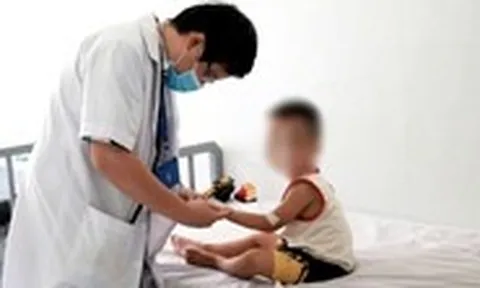 Số ca mắc tay chân miệng tại Khánh Hòa tăng gấp 4 lần, bước vào chu kỳ bùng phát