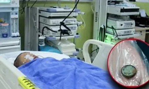 Bé trai 3 tuổi nuốt phải pin cúc áo, mẹ cho uống ngay 1 thìa gia vị, đến bệnh viện bác sĩ khen: "Giỏi lắm"