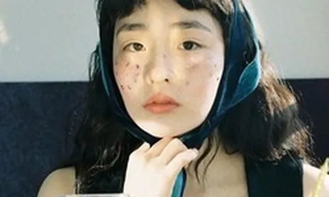 Các bác sĩ khuyên: Không cần chờ tới lúc ngứa da, thấy 7 dấu hiệu này trên mặt tức là máu đã "ngập đường"