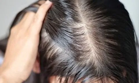 Lời khuyên cho những người hay bị rụng tóc