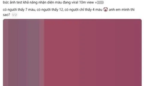 “Bức ảnh đếm màu đang viral với 10 triệu view”: Đáp án cuối cùng là gì?