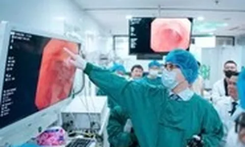 Khi nào người trẻ nên đi nội soi tiêu hóa?