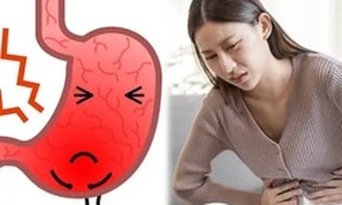 Cảnh báo: Không phải đồ ăn cay, đây mới là 4 "thủ phạm" gây ung thư dạ dày phổ biến nhất