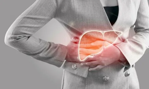 Chuyên gia giải đáp các cách điều trị sỏi cổ túi mật hiệu quả