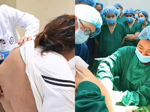Mổ lấy thai cho sản phụ Phú Thọ nặng 178kg, không thể gây tê tủy sống vì lớp mỡ dày hơn 11cm