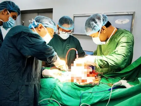 Khối u buồng trứng khổng lồ chiếm gần trọn bụng dưới của bệnh nhân 20 tuổi