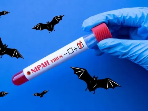 Bác sĩ bệnh viện tuyến đầu nói thẳng về virus Nipah