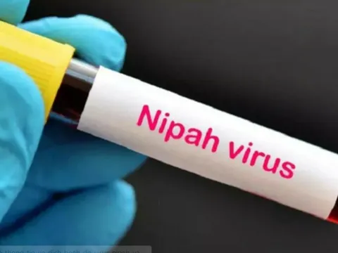 Bác sĩ Bệnh viện Chợ Rẫy chỉ ra 3 con đường lây truyền virus Nipah, nhắc mọi người hiểu đúng để cảnh giác “không hoang mang”