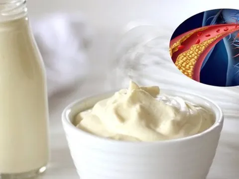 Loại thực phẩm giới trẻ đặc biệt yêu thích nhưng cẩn trọng kẻo gây rối loạn mỡ máu