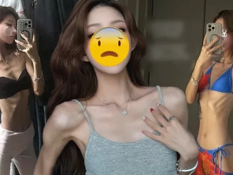 Phát sợ với cơ thể gầy trơ xương, héo mòn của con gái "nữ diễn viên quốc dân"