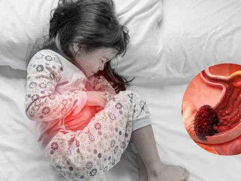 Bé gái 13 tuổi mắc ung thư dạ dày giai đoạn cuối, nguyên nhân đến từ thói quen của bố